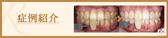 症例紹介