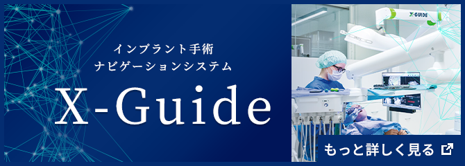 X-guide(Xガイド)