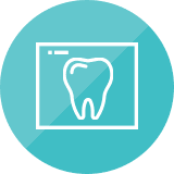 インプラントオーバーデンチャー