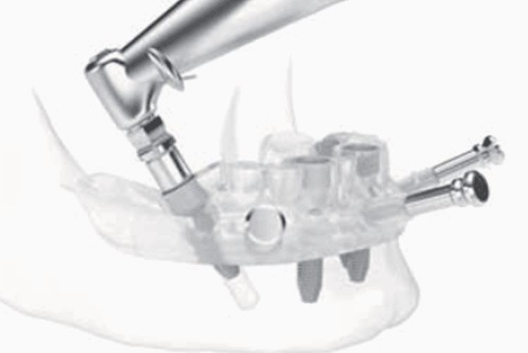 身体への負担が少なく、さらに正確かつ安全なシステムです