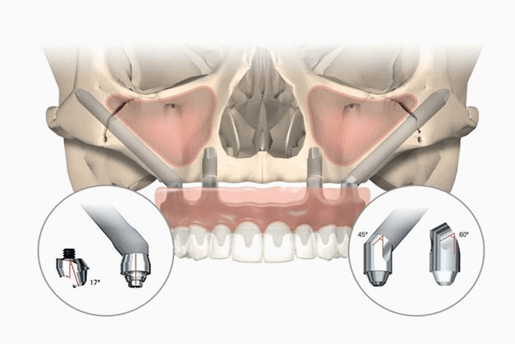 身体への負担が少なく、さらに正確かつ安全なシステムです