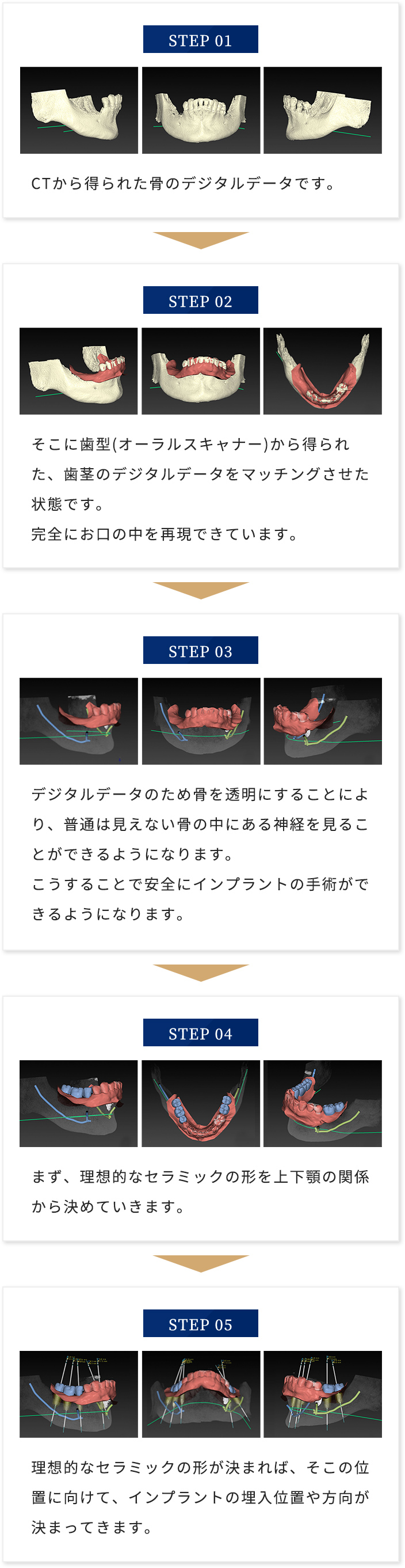 シミュレーションstep